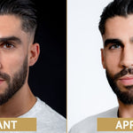 lentilles bleues pour les yeux foncés