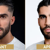 lentilles bleues pour les yeux foncés